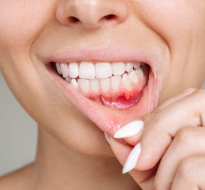 Dental Examination